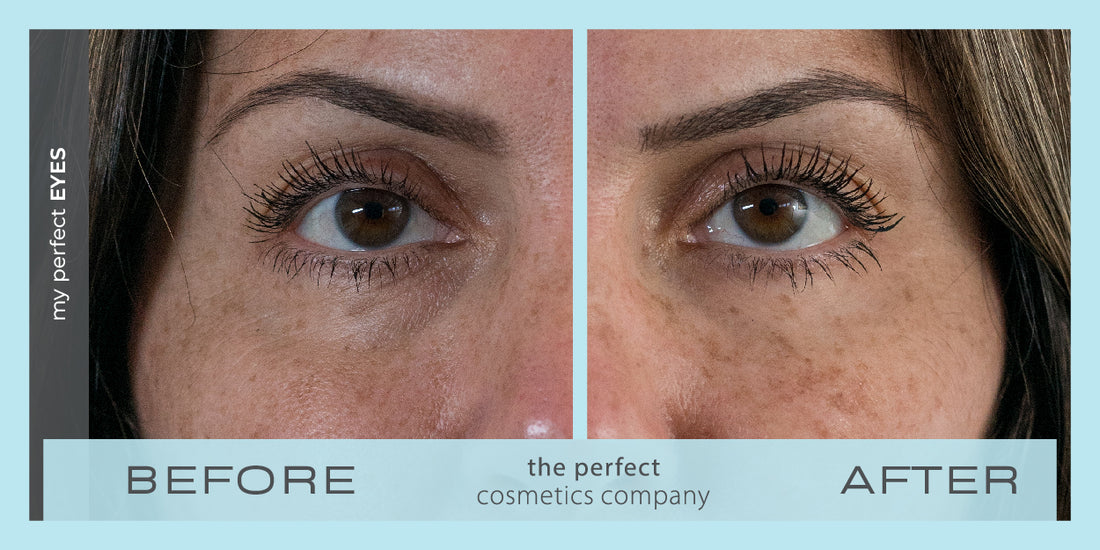Before and after results
